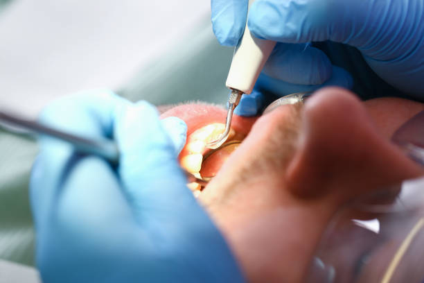 Best Urgent Dental Care for Toothache in Buies Creek, NC