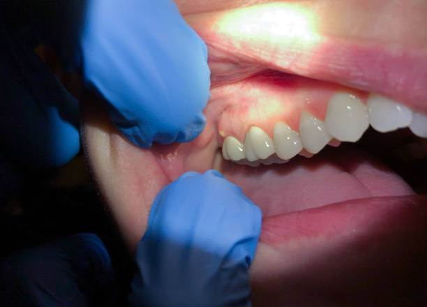 Best Weekend Emergency Dentist in Buies Creek, NC